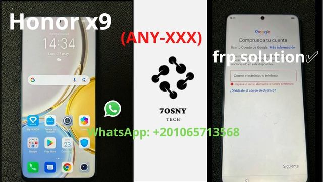 Honor X9 (ANY-XXX) Frp Solution✅