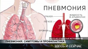 ПНЕВМОНИЯ  СИМПТОМЫ И ПРОФИЛАКТИКА