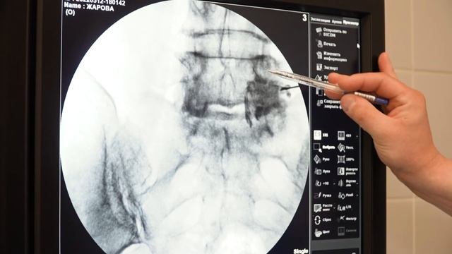 Современная нейрохирургия в Москве