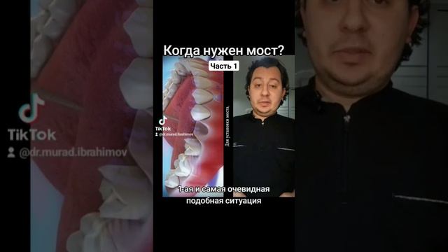 Когда нужны мосты Ч.1 #стоматолог #стоматология #протезированиезубов #мостик #коронки #коронканазуб смотреть онлайн