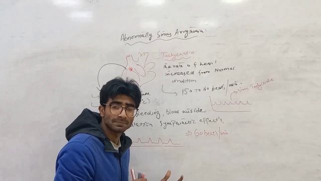 abnormal sinus arrythmia | bradycardia,tachycardia ..heart rate..an.overview. смотреть онлайн