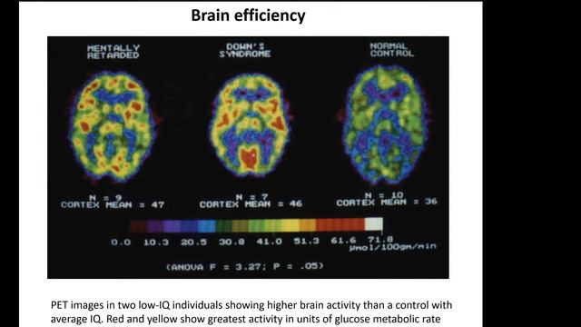 Тесты на IQ смотреть онлайн