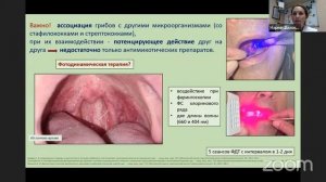 ХРОНИЧЕСКИЙ ФАРИНГИТ В ВОПРОСАХ И ОТВЕТАХ. ВЗГЛЯД ОТОРИНОЛАРИНГОЛОГА НА МЕЖДИСЦИПЛИНАРНУЮ ПРОБЛЕМУ.