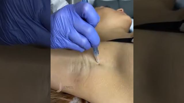 Косметолог в Аликанте | JetPeel | Alicante