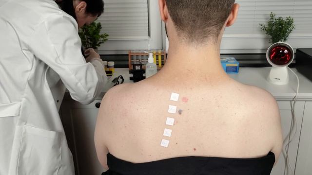 Allergy Skin Test & Check Up On The Back [ASMR] *Annual Doctor Visit*