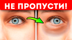 Вот о чём тело нас предупреждает через круги и мешки под глазами! Темные круги под глазами могут...