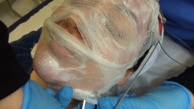 Skin Quest: Azelaic peel, vitamin infusion & LED light therapy. смотреть онлайн