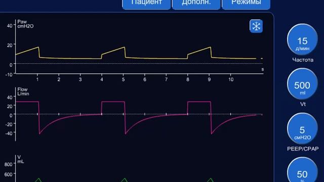 Управление вдохом при ИВЛ Горячев А.С. смотреть онлайн