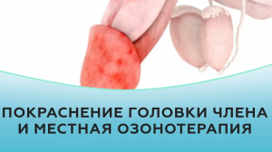Покраснение головки члена и местная озонотерапия