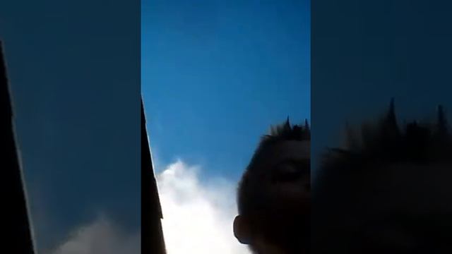 Разбил нос жесть смотреть онлайн