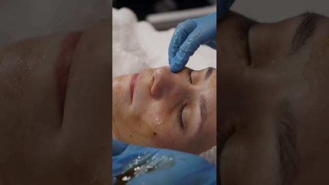 Пилинг джесснера смотреть онлайн