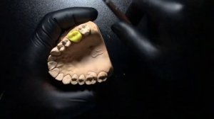 Моделирование зубов из воска