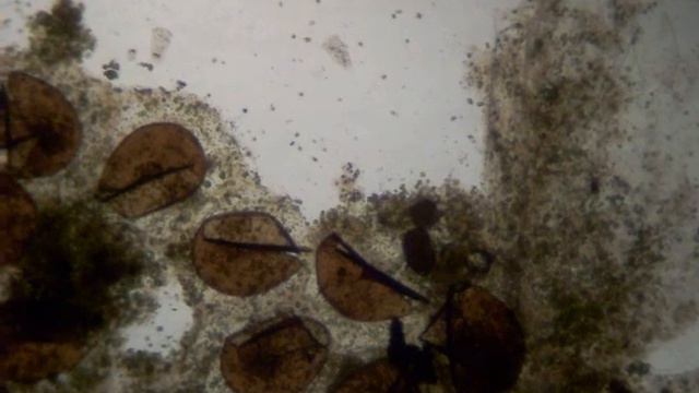 Two Vorticellas and Grass Spores смотреть онлайн