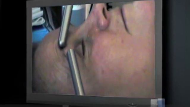 Surface Clinic Presents Doctor Alex De Souza Part II смотреть онлайн