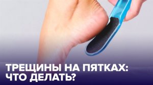 Почему ТРЕСКАЮТСЯ ПЯТКИ? Правила ухода за ногами