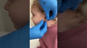 Система-75 прокол ушей