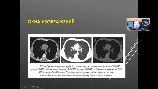 Физические основы рентгеновской компьютерной томографии смотреть онлайн