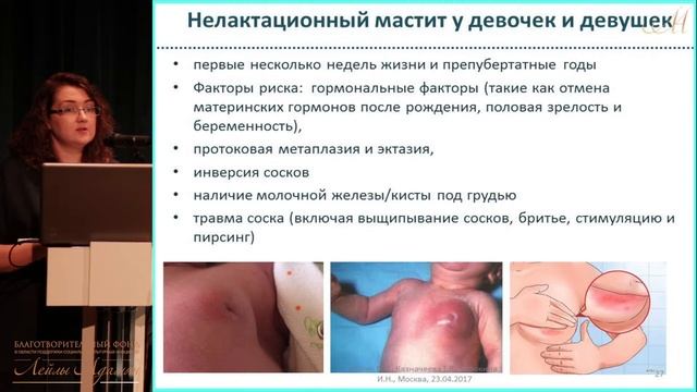 23 апреля 2017 г. Лекция "Молочная железа – особенности нормы и патологии у детей и подростков" смотреть онлайн