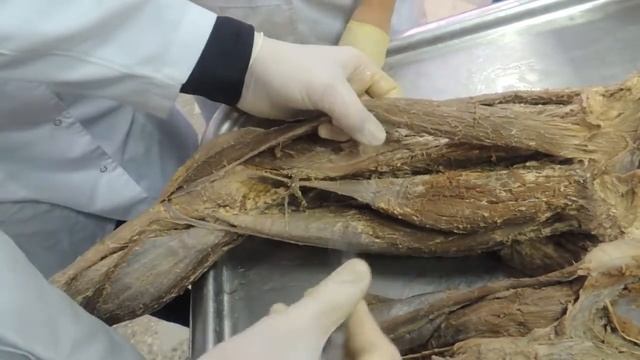 Мышцы Таз,Бедро смотреть онлайн
