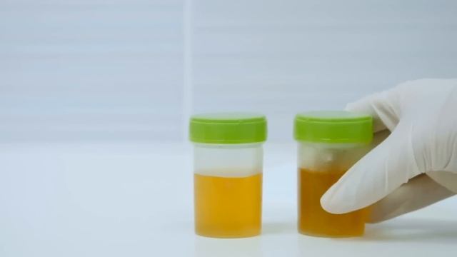 Калий – самый важный нутриент! А дефицит калия есть у всех? смотреть онлайн