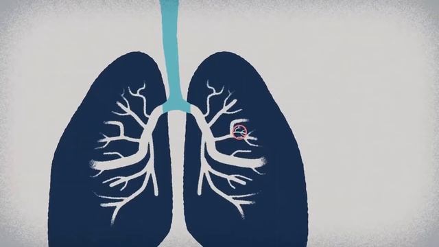 1. Что такое загрязнение воздуха? смотреть онлайн