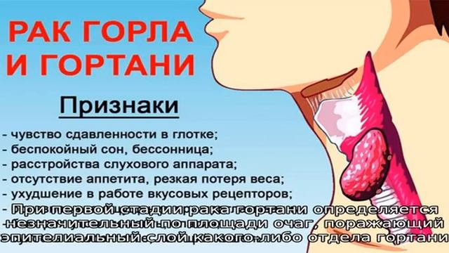Рак гортани 4 степени смотреть онлайн