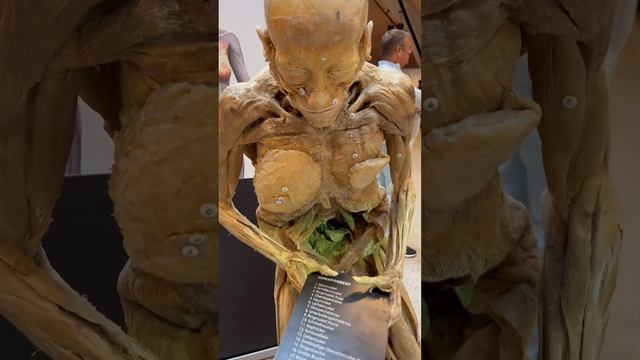 Музей настоящих тел в Германии. Все экспонаты - это люди, завещавшие свои тела музею. смотреть онлайн