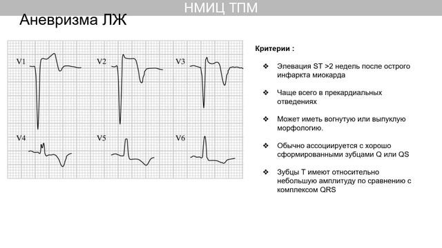ВОРКШОП ПО ЭКГ Чащин М_cut_001