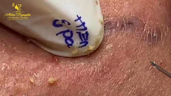 Satisfying Hien Spa Beauty Relaxing Video #28