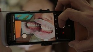 Дентальная фотография Smile Lite MDP