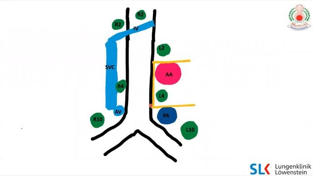 Thoracic Lymph Nodes | Part 1 смотреть онлайн