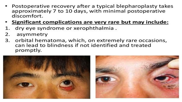 Rhinoplasty, Otoplasty and Facelift смотреть онлайн