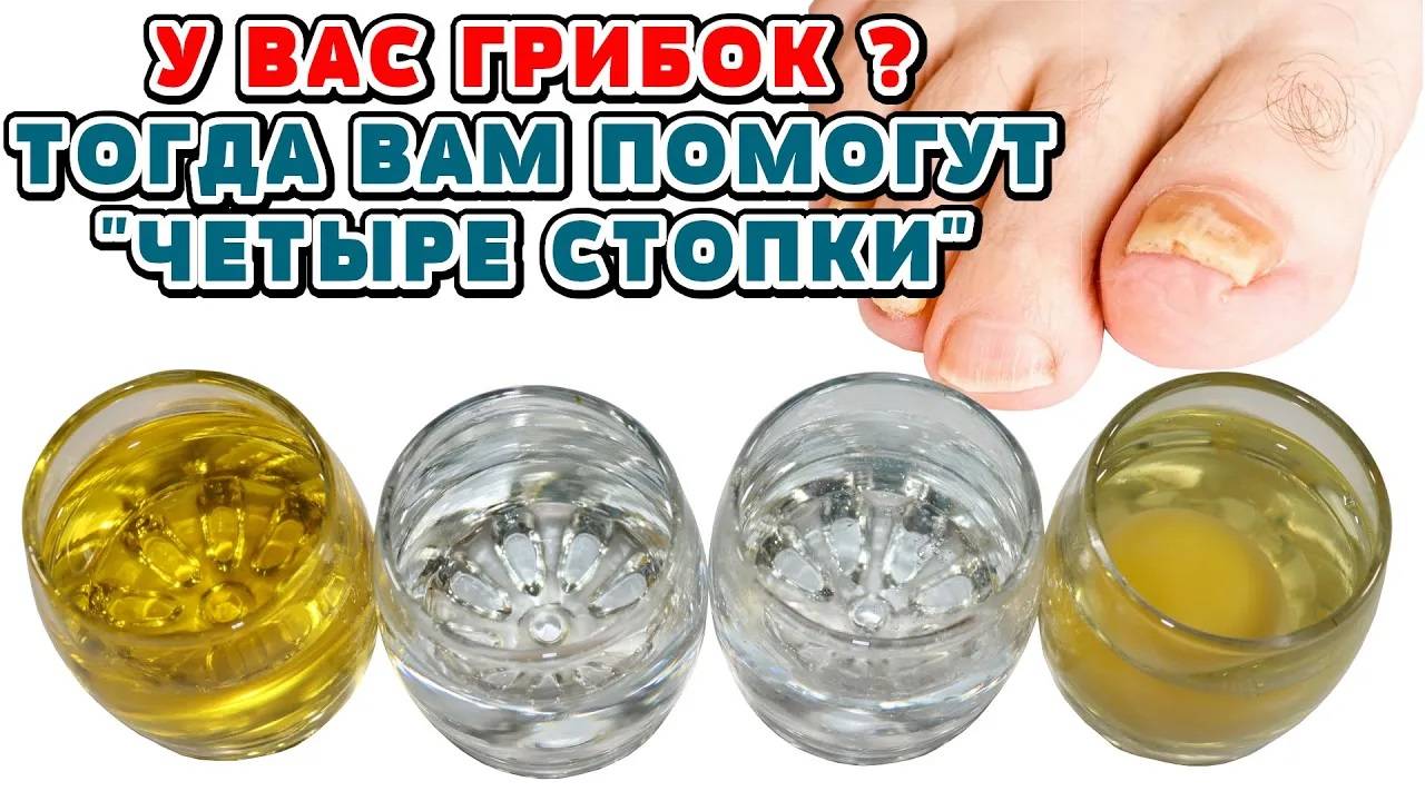 Грибок? Не паникуйте! 4 стопки вам в помощь! смотреть онлайн