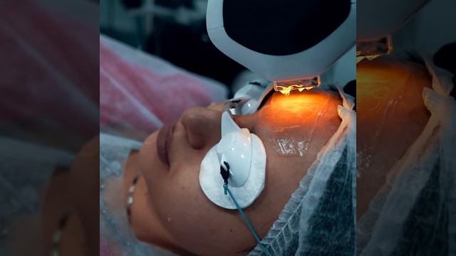 Kuperoz, piqment ləkələrini ləğv edən INMODE LUMECCA. Dr. Nigar VƏLİZADƏ смотреть онлайн