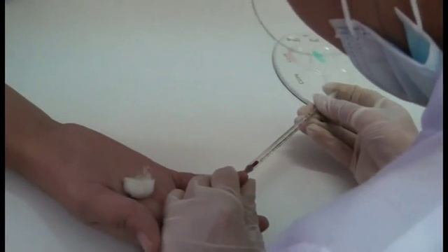 Цоликлондардың көмегімен қан тобын және факторды анықтау (Определение группы крови, резус-фактора) смотреть онлайн