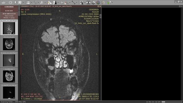 Tutorial de visor de archivos Dicom смотреть онлайн