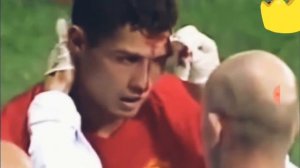 Страшные травмы роналду