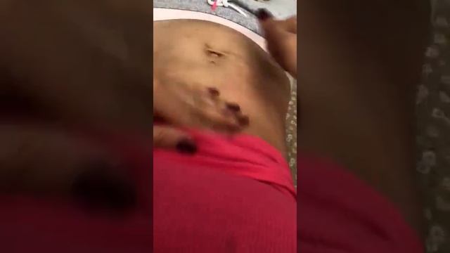 Фитнесмама. Массаж подушечками пальцев. смотреть онлайн