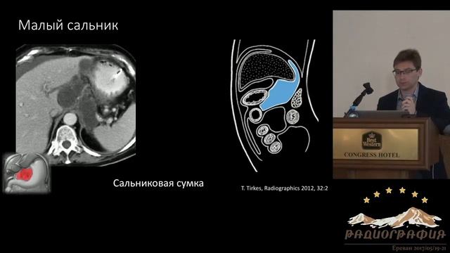 Кирилл Петров. Анатомия и семиотика поражений брюшины. смотреть онлайн