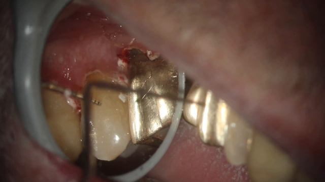 Gold Crown 50 Years and Counting смотреть онлайн