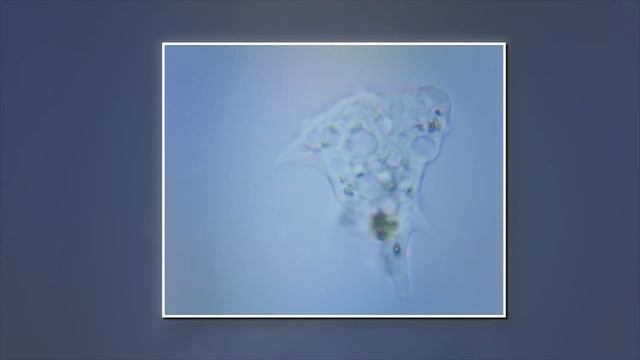 Амеба, Amoeba. Микромед / Micromed Р-1