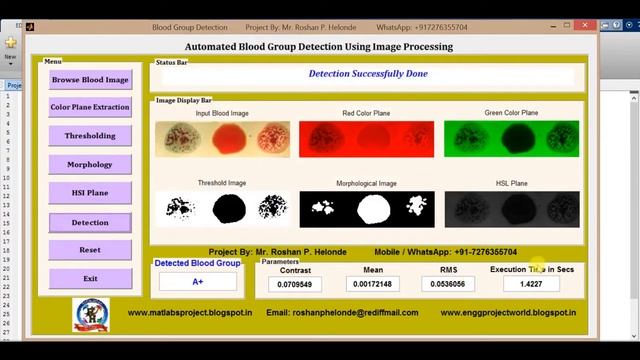 Top 20 Biomedical Projects | With Source Code | Latest Best 20 Image Processing Project Source Code смотреть онлайн