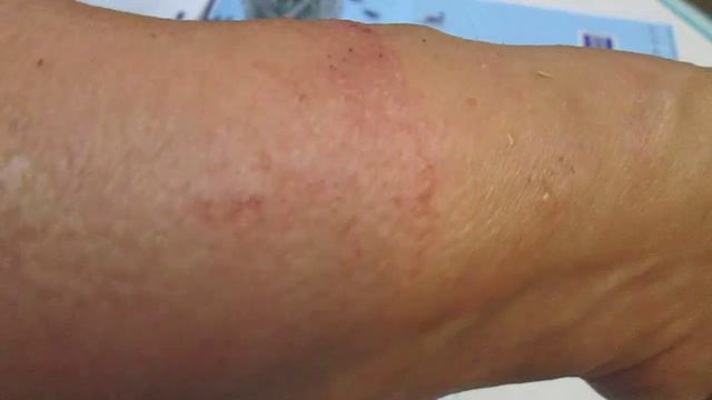 БГВ 81 Чёрная Львинка Борщевик часть 7 смотреть онлайн