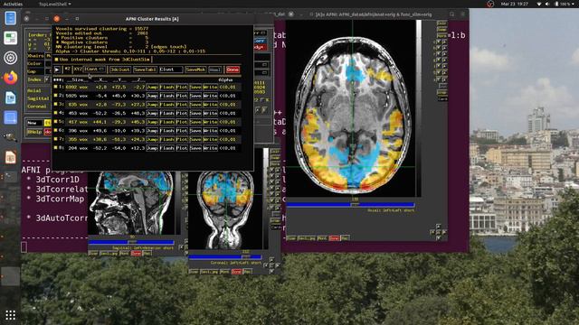 [AFNI Academy] AFNI GUI: Clusterizing смотреть онлайн