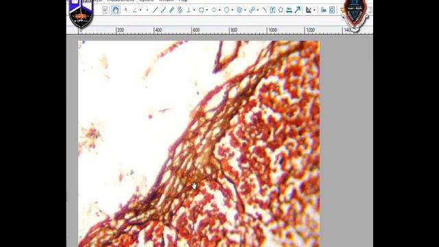General Histology I Practical 3 I Part 1 I Connective Tissue Fibers смотреть онлайн