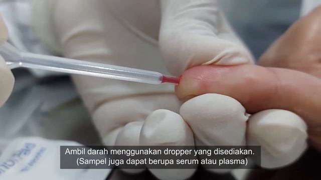 Prosedur Penggunaan DBDFast Dengue NS1 Antigen Rapid Test смотреть онлайн
