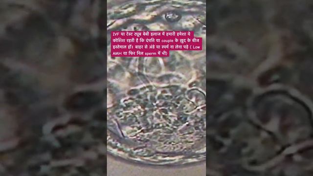 blastocyst transfer #embryotransfer #embryofreezing смотреть онлайн