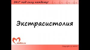 Нарушения ритма сердца - синусовые ритмы, экстрасистолия