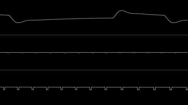 Zardax - Extremes (C64) [Oscilloscope View] смотреть онлайн