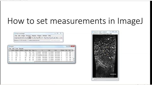 5. How To Set Measurements In ImageJ